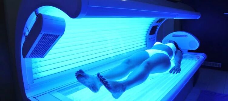 Vene varicoase și solarium