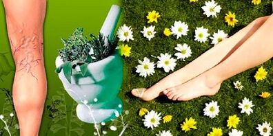tratamentul varicelor cu remedii populare